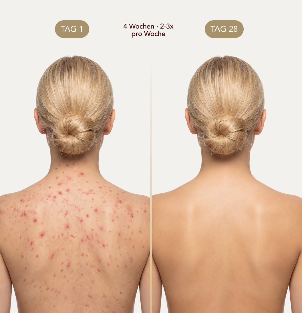 Nurali Peeling-Duschtuch™