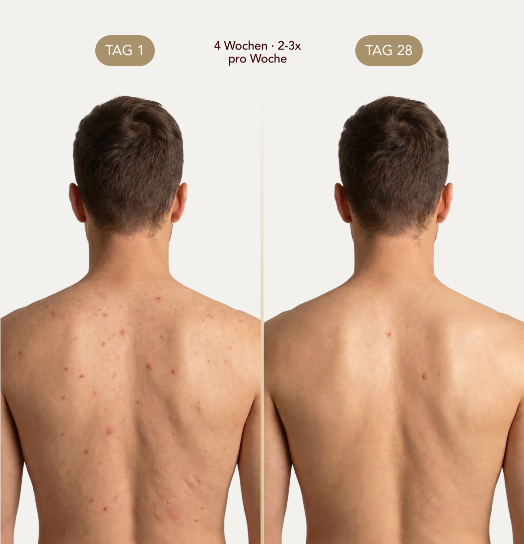 Nurali Peeling-Duschtuch™