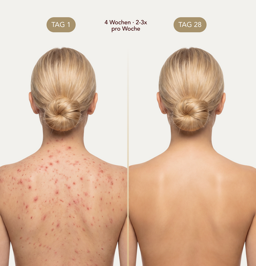 Nurali Peeling-Duschtuch™
